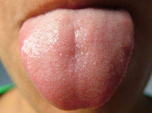 Saca la lengua